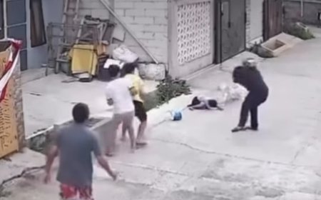 Tragis! Bocah Kelas 3 SD di Bandung Alami Luka Berat di Kepala Usai Diserang Pitbull