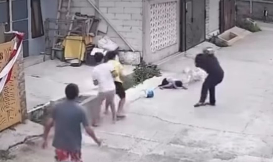 Tragis! Bocah Kelas 3 SD di Bandung Alami Luka Berat di Kepala Usai Diserang Pitbull