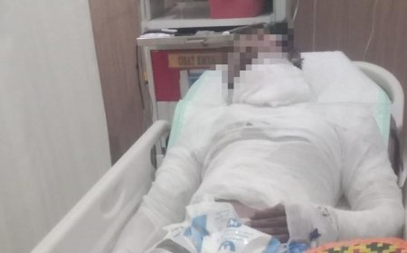 Sopir Dibakar Majikan, Polisi Ungkap Motif Pelaku Gelap Mata