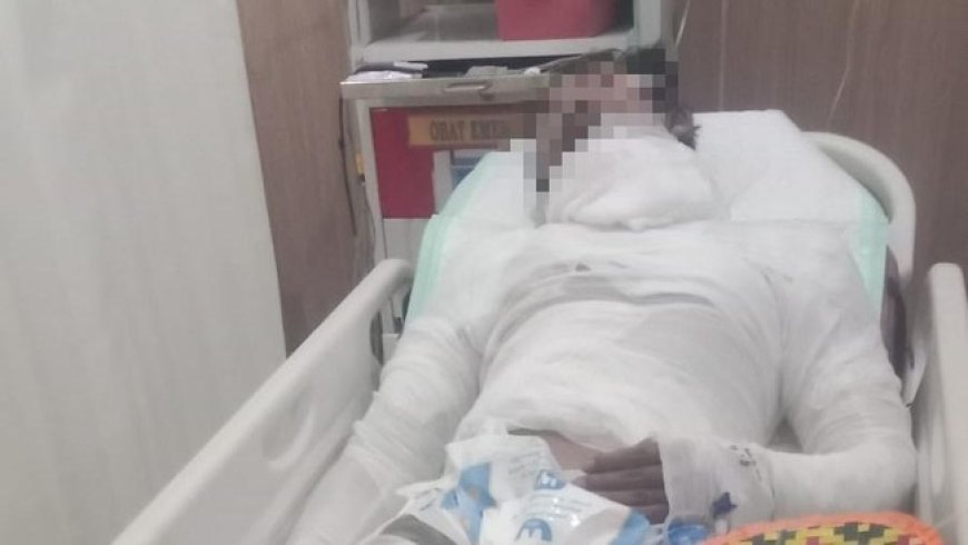 Sopir Dibakar Majikan, Polisi Ungkap Motif Pelaku Gelap Mata
